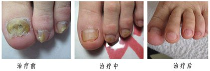 兰州北大皮肤科